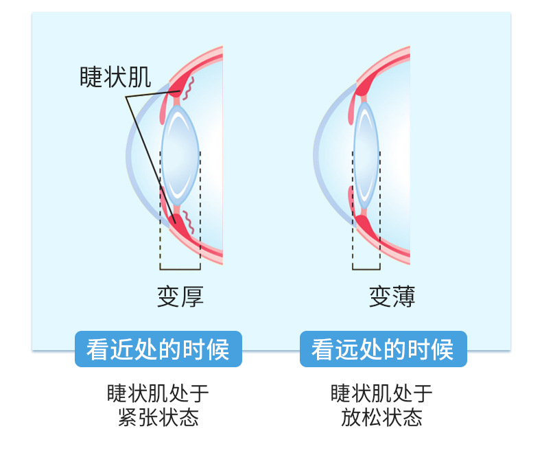 Manufacturer Runnuoming Welder Eye Care Drops Investment Promotion Wholesale OEM Processing